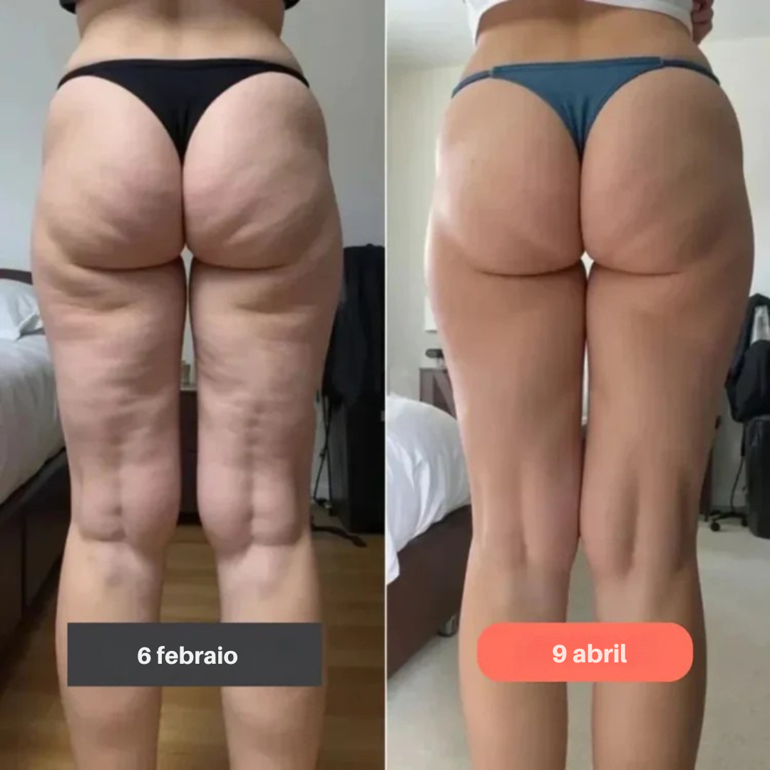 Mejora la apariencia de la celulitis desde dentro   Fórmula con Gotu Kola que favorece la firmeza de la piel