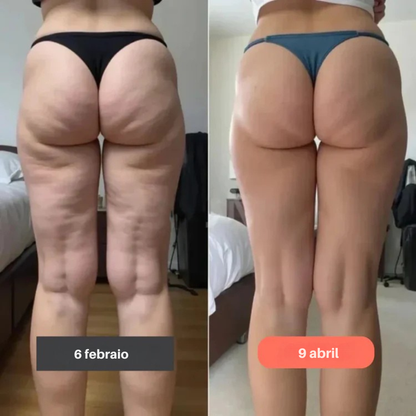 Mejora la apariencia de la celulitis desde dentro   Fórmula con Gotu Kola que favorece la firmeza de la piel