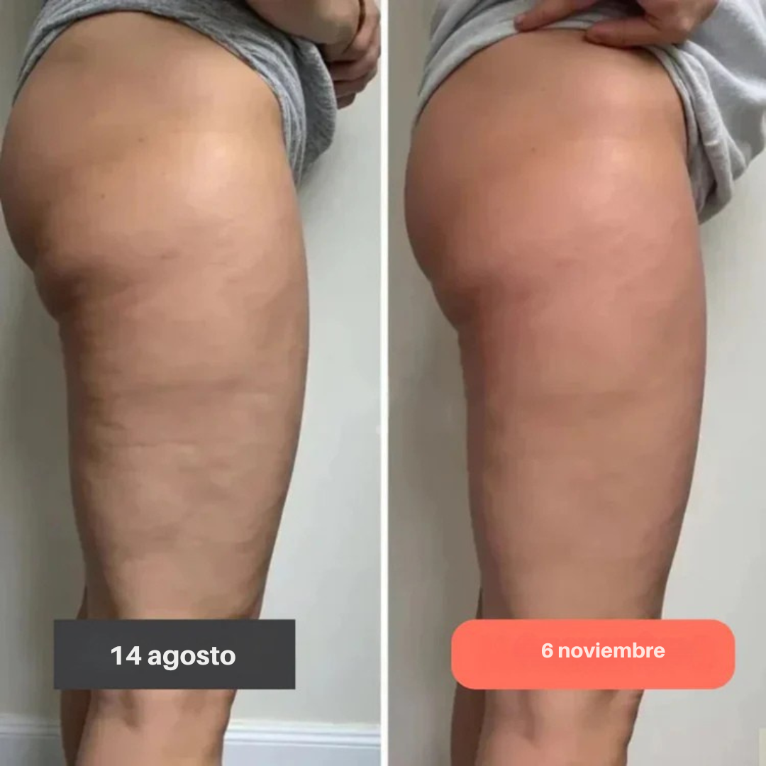 Mejora la apariencia de la celulitis desde dentro   Fórmula con Gotu Kola que favorece la firmeza de la piel
